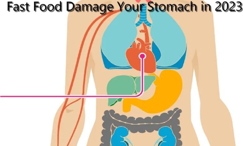 The Grim Reality: How Fast Food Damage Your Stomach in 2023